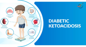 DIABETIC KETOACIDOSIS