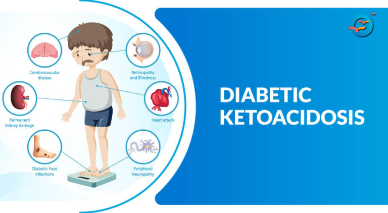 DIABETIC KETOACIDOSIS