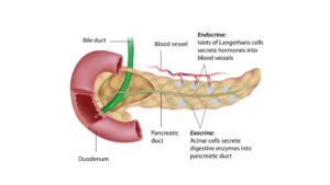 EXOCRINE PANCREATIC INSUFFICIENCY