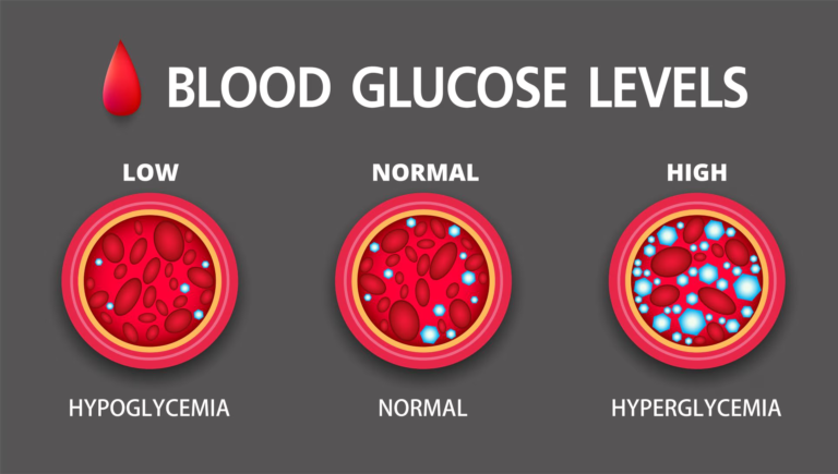 HYPERGLYCEMIA