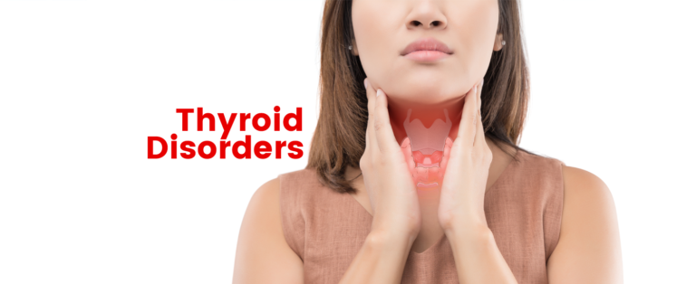 THYROID DISEASE