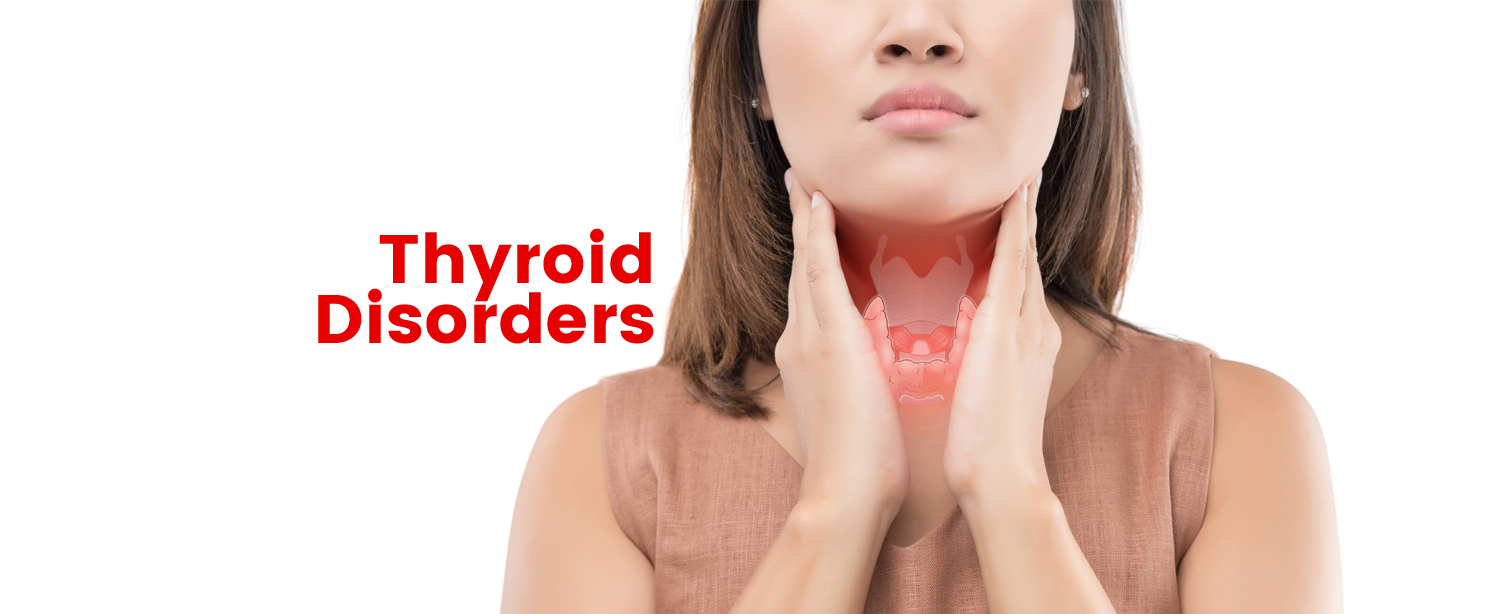 THYROID DISEASE