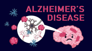 ALZHEIMER'S DISEASE