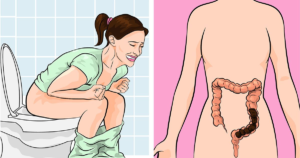 CONSTIPATION