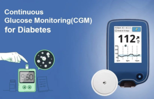 CONTINUOUS GLUCOSE MONITOR