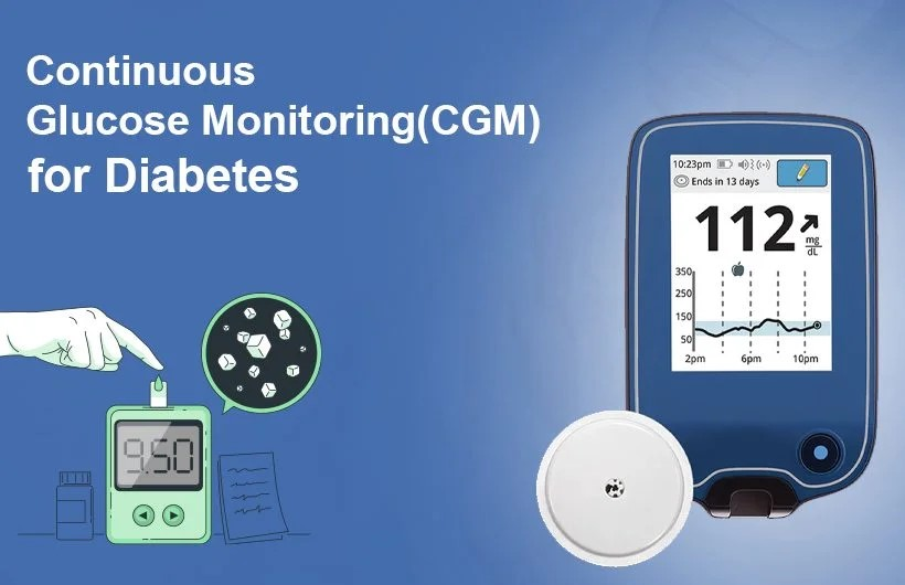 CONTINUOUS GLUCOSE MONITOR