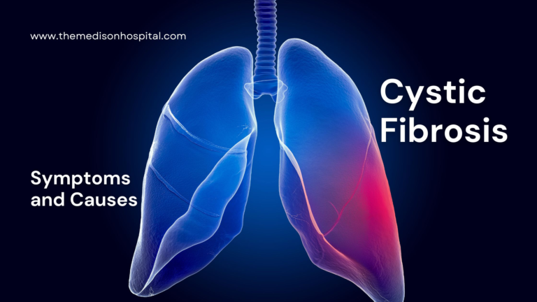 CYSTIC FIBROSIS