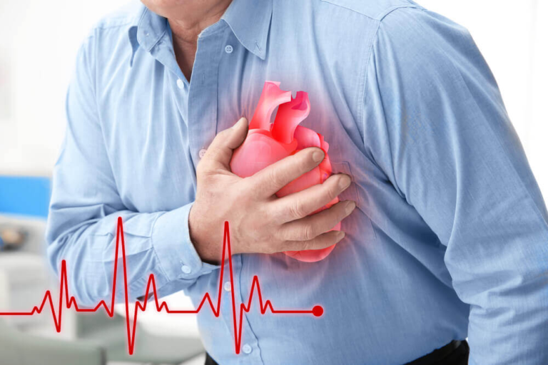 HEART ATTACK