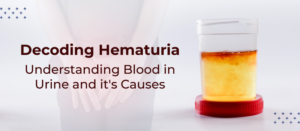 HEMATURIA (BLOOD IN THE URINE)