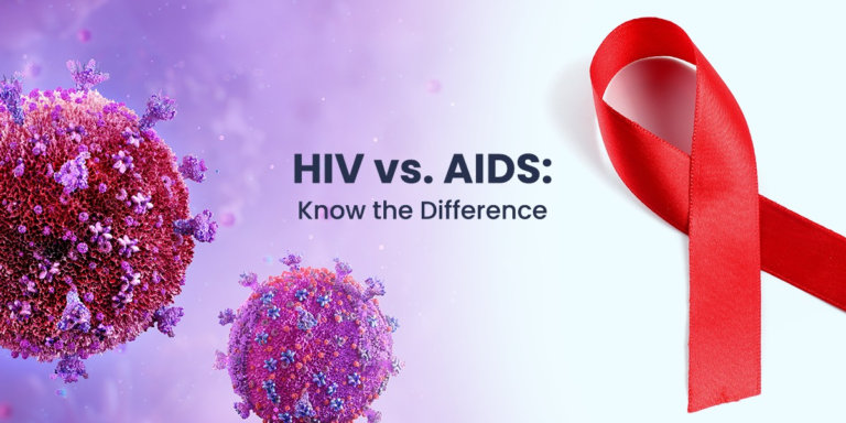 HIV AIDS