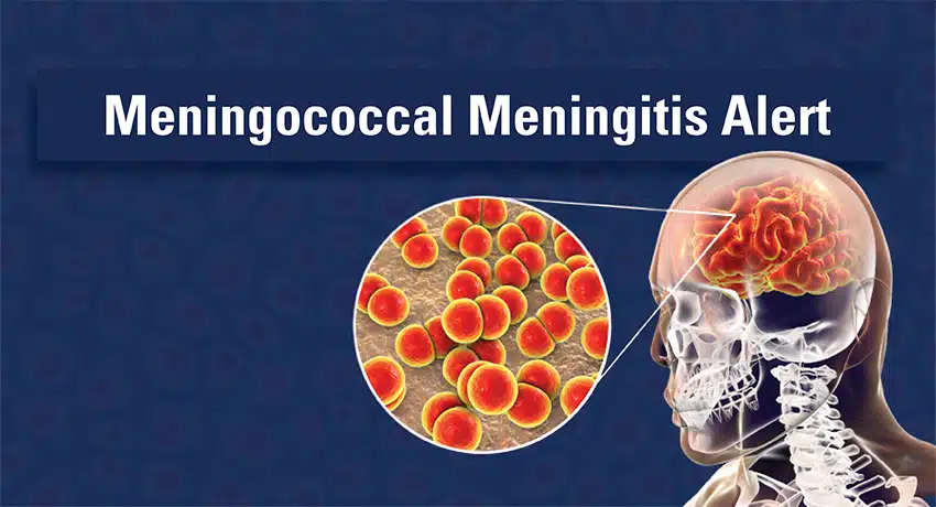 MENINGOCOCCAL MENINGITIS