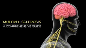 MULTIPLE SCLEROSIS
