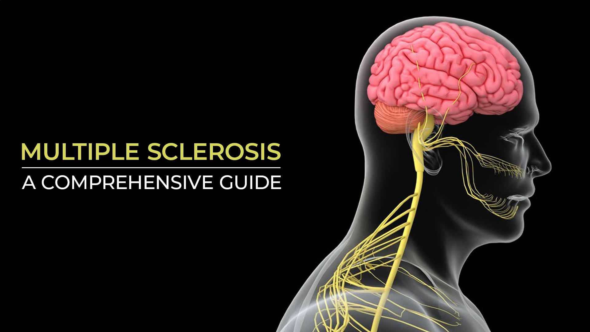 MULTIPLE SCLEROSIS