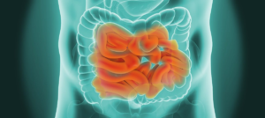 SMALL INTESTINE CANCER