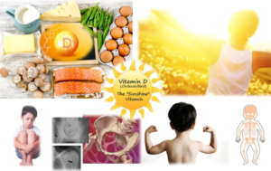 VITAMIN D DEFICIENCY
