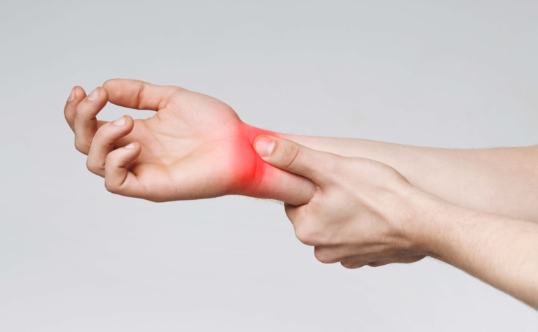 CARPAL TUNNEL SYNDROME