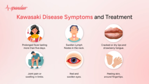 KAWASAKI DISEASE