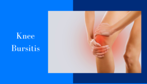 KNEE BURSITIS