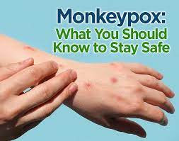 Monkeypox
