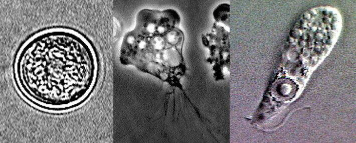NAEGLERIA INFECTION