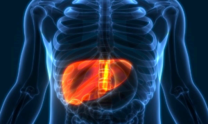 NONALCOHOLIC FATTY LIVER DISEASE (NAFLD)