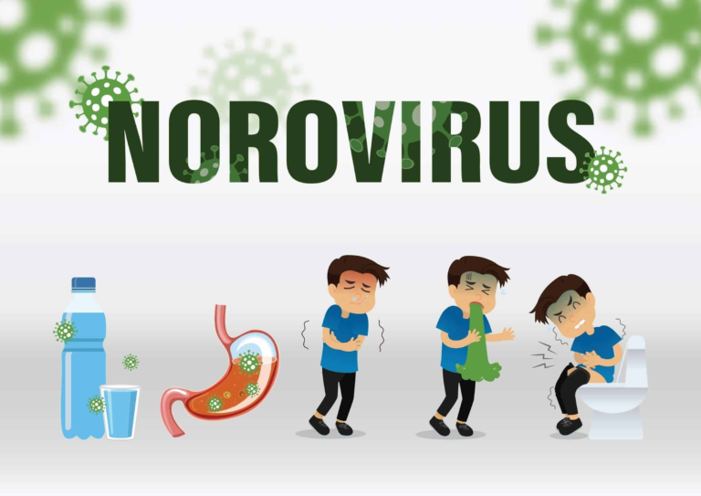 NOROVIRUS INFECTION