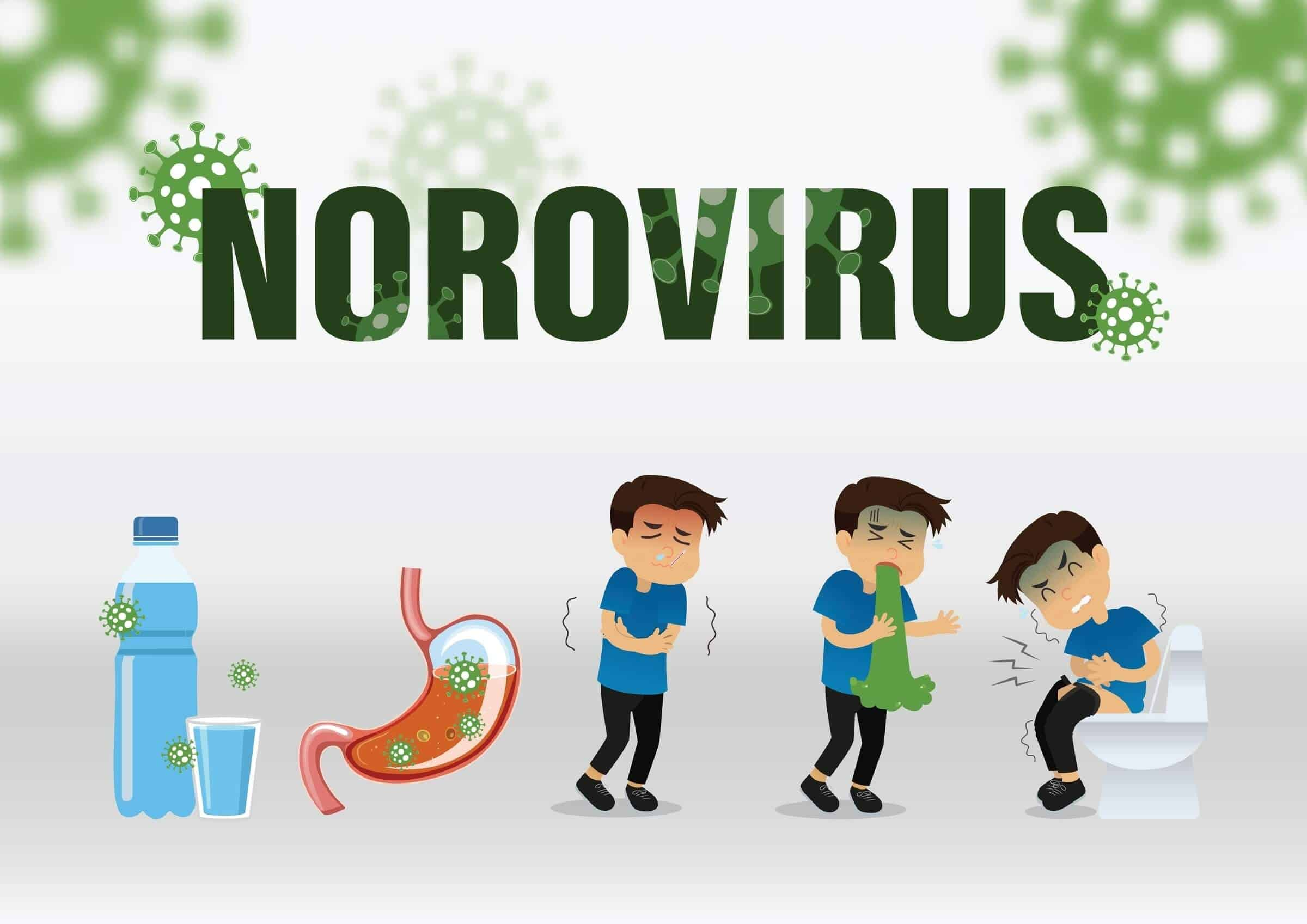 NOROVIRUS INFECTION