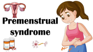PREMENSTRUAL SYNDROME (PMS)