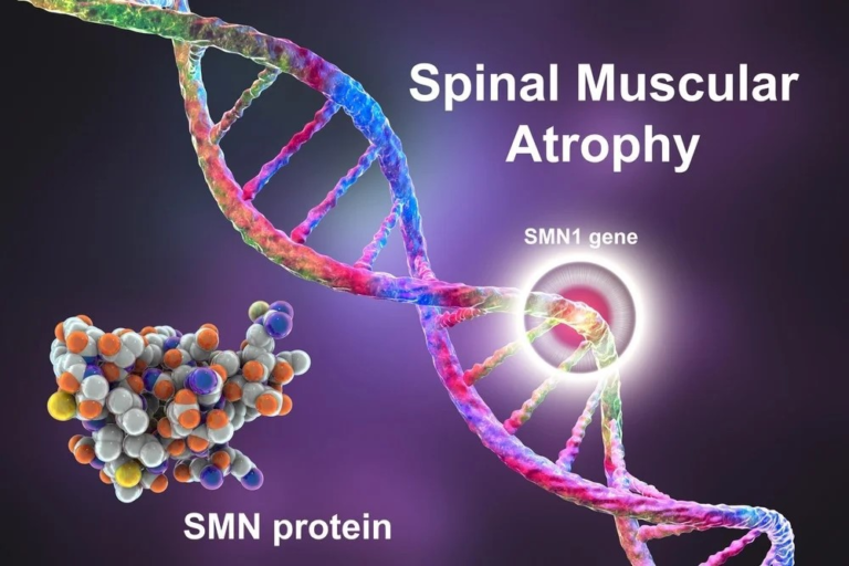 SPINAL MUSCULAR ATROPHY