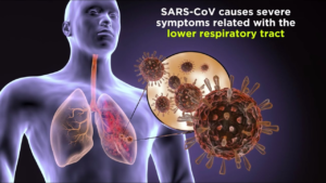 Severe Acute Respiratory Syndrome