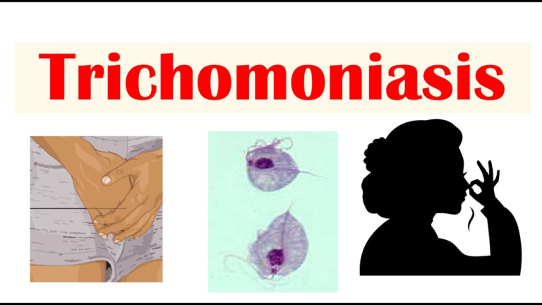 TRICHOMONIASIS
