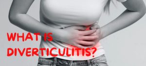 DIVERTICULITIS