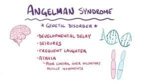 ANGELMAN SYNDROME