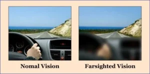 FARSIGHTEDNESS