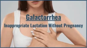 GALACTORRHEA