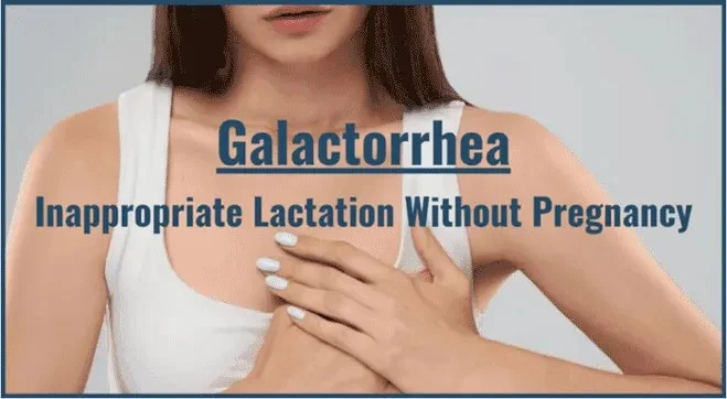 GALACTORRHEA