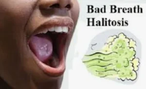 BAD BREATH