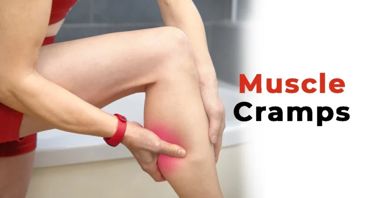 MUSCLE CRAMP