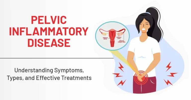 PELVIC INFLAMMATORY DISEASE (PID)