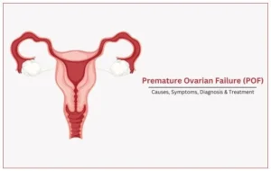 PRIMARY OVARIAN INSUFFICIENCY