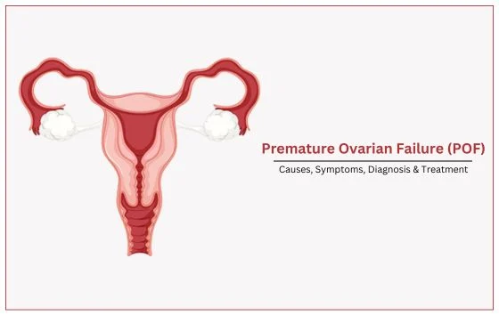 PRIMARY OVARIAN INSUFFICIENCY