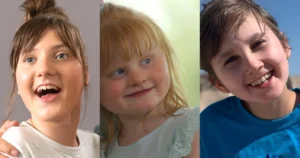 Rett Syndrome