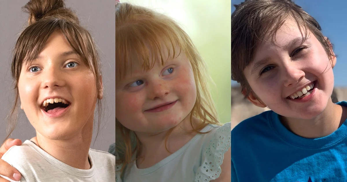 Rett Syndrome