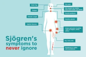 SJOGREN'S SYNDROME