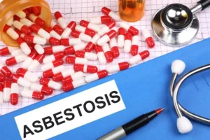 ASBESTOSIS
