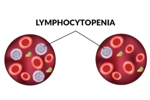LYMPHOCYTOPENIA