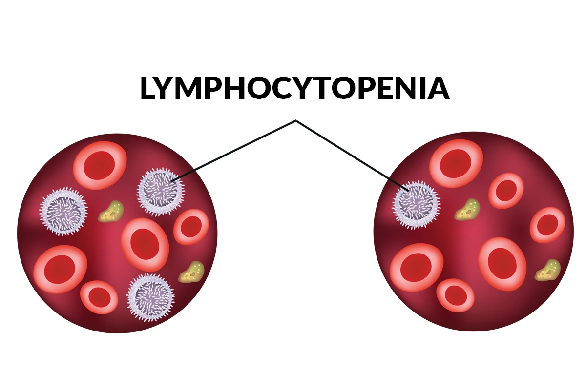 LYMPHOCYTOPENIA