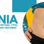 Umbilical Hernia