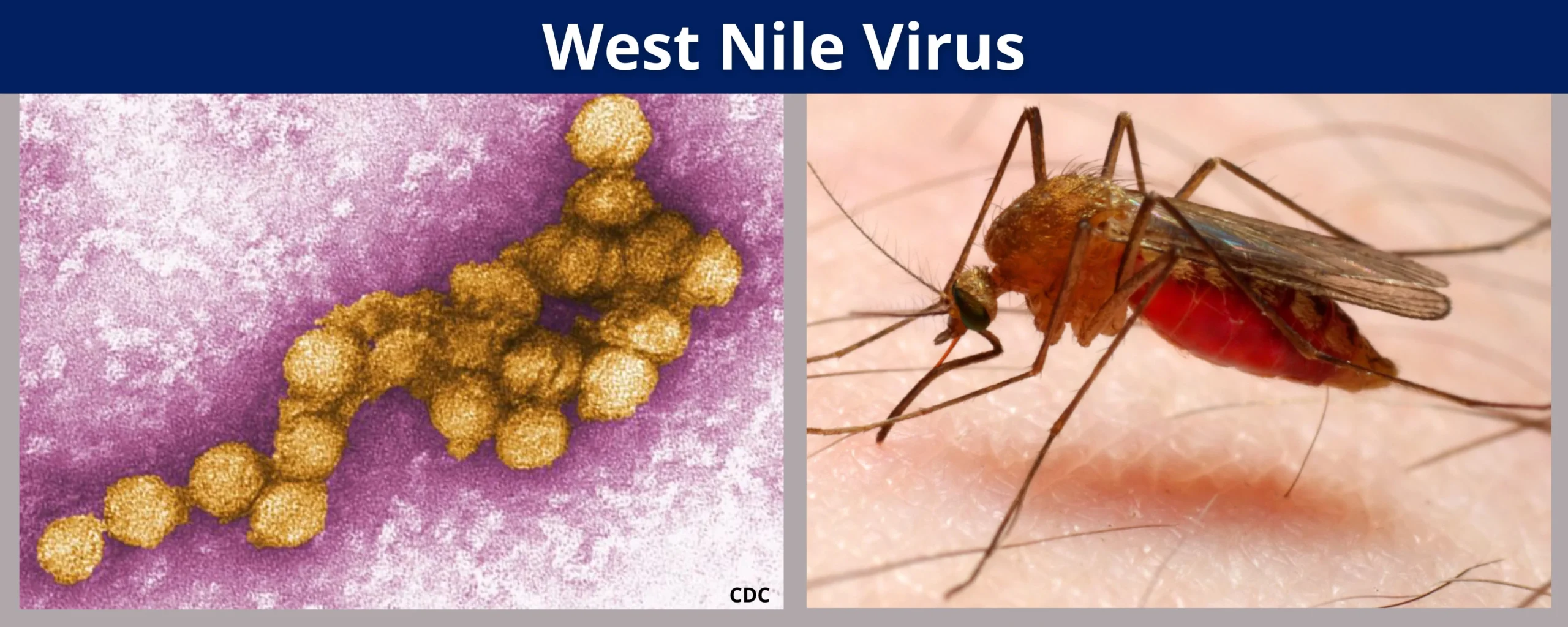 West Nile Virus