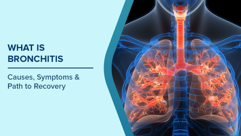 Bronchitis